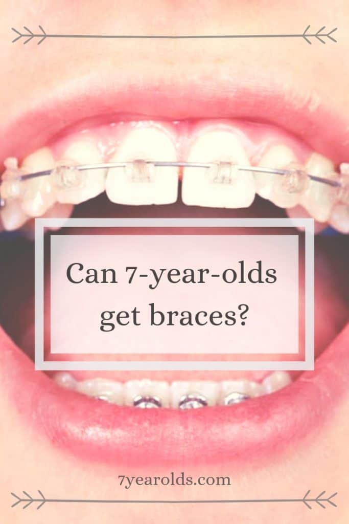 Can 7YearOlds Get Braces? 7 Year Olds