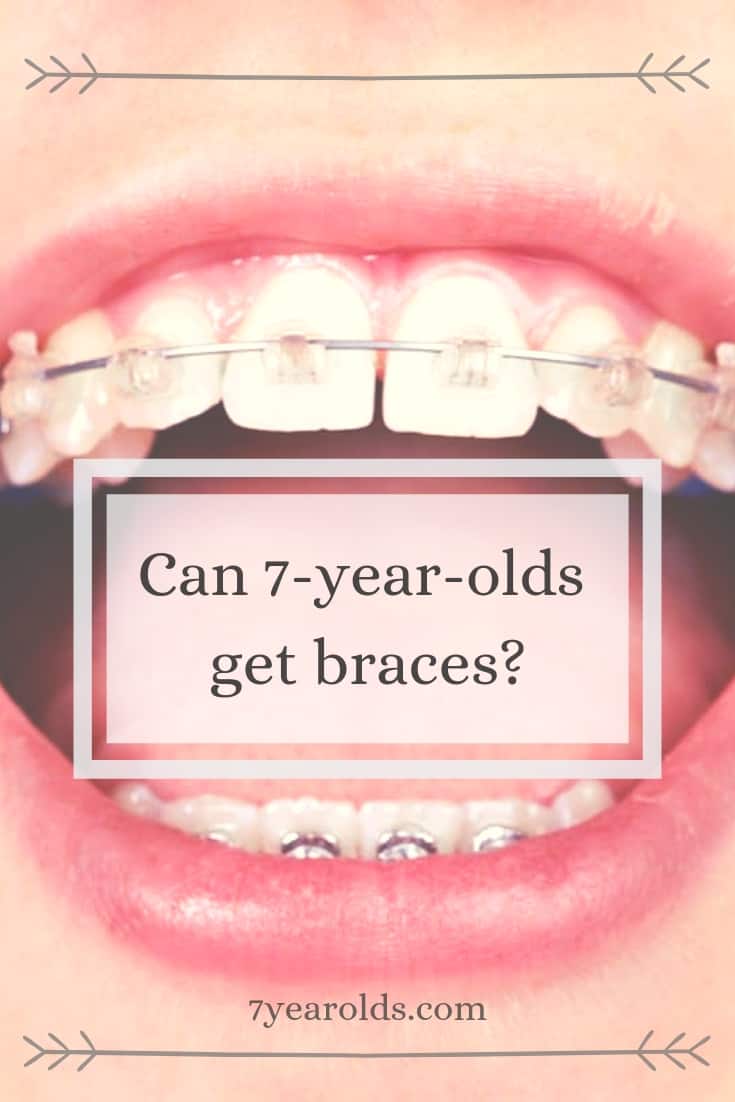 Can 7YearOlds Get Braces? 7 Year Olds